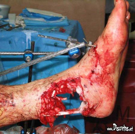 haaa!!! il doit avoir tp mal!!!